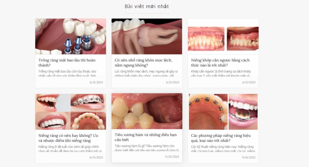 Tạo Series bài viết và sử dụng Internal Link
